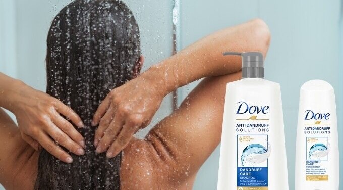 home-treatments-for-dandruff