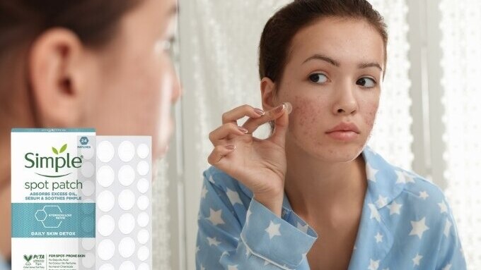 FAQs about Acne Prone Skin