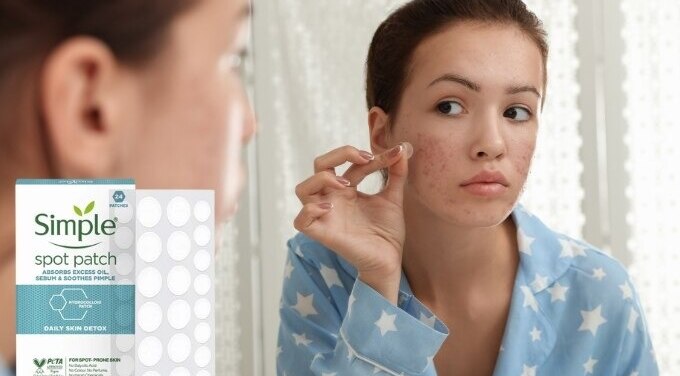 FAQs about Acne Prone Skin