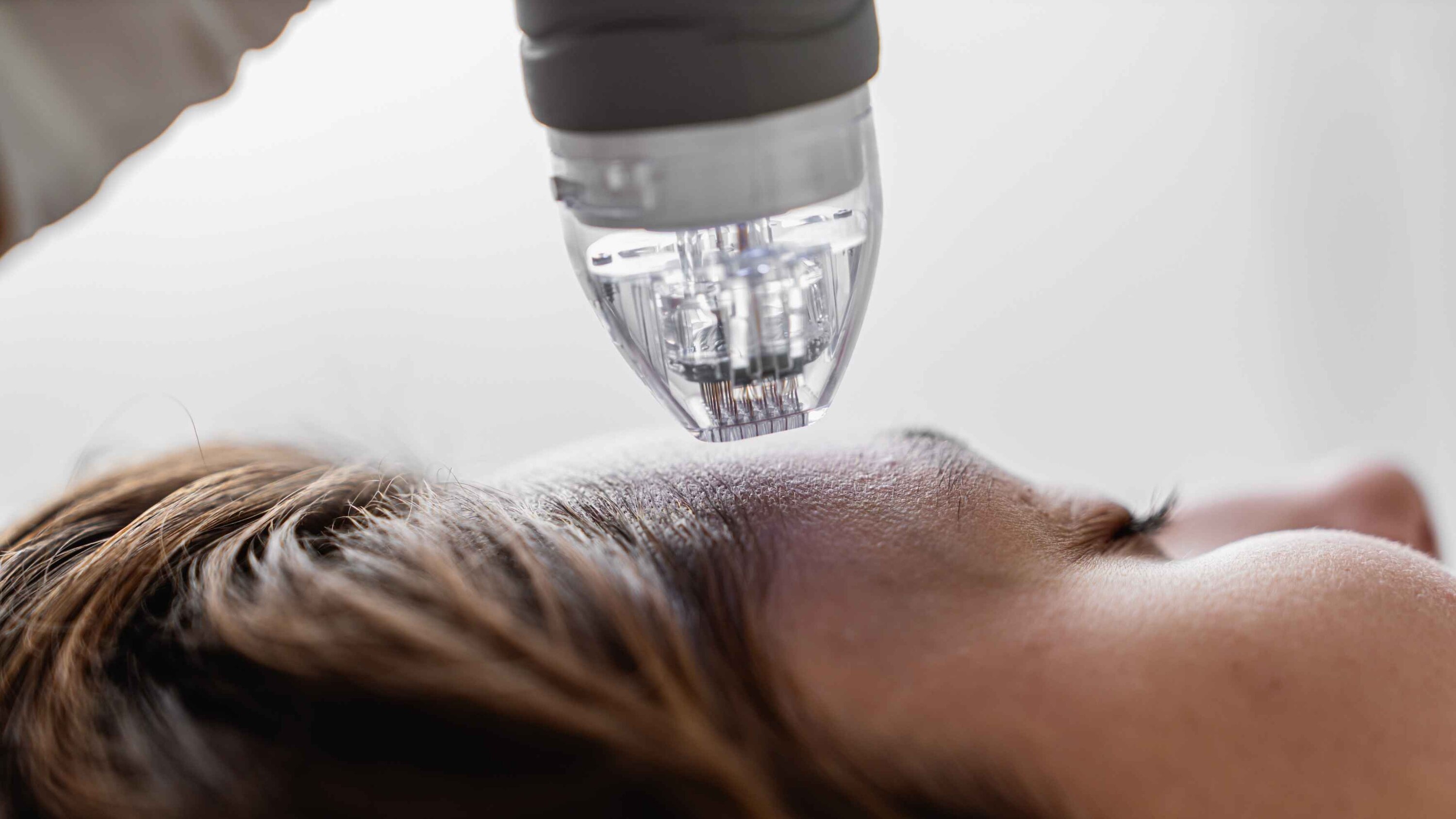 Hair Growth Serums and Treatments: What Actually Helps?