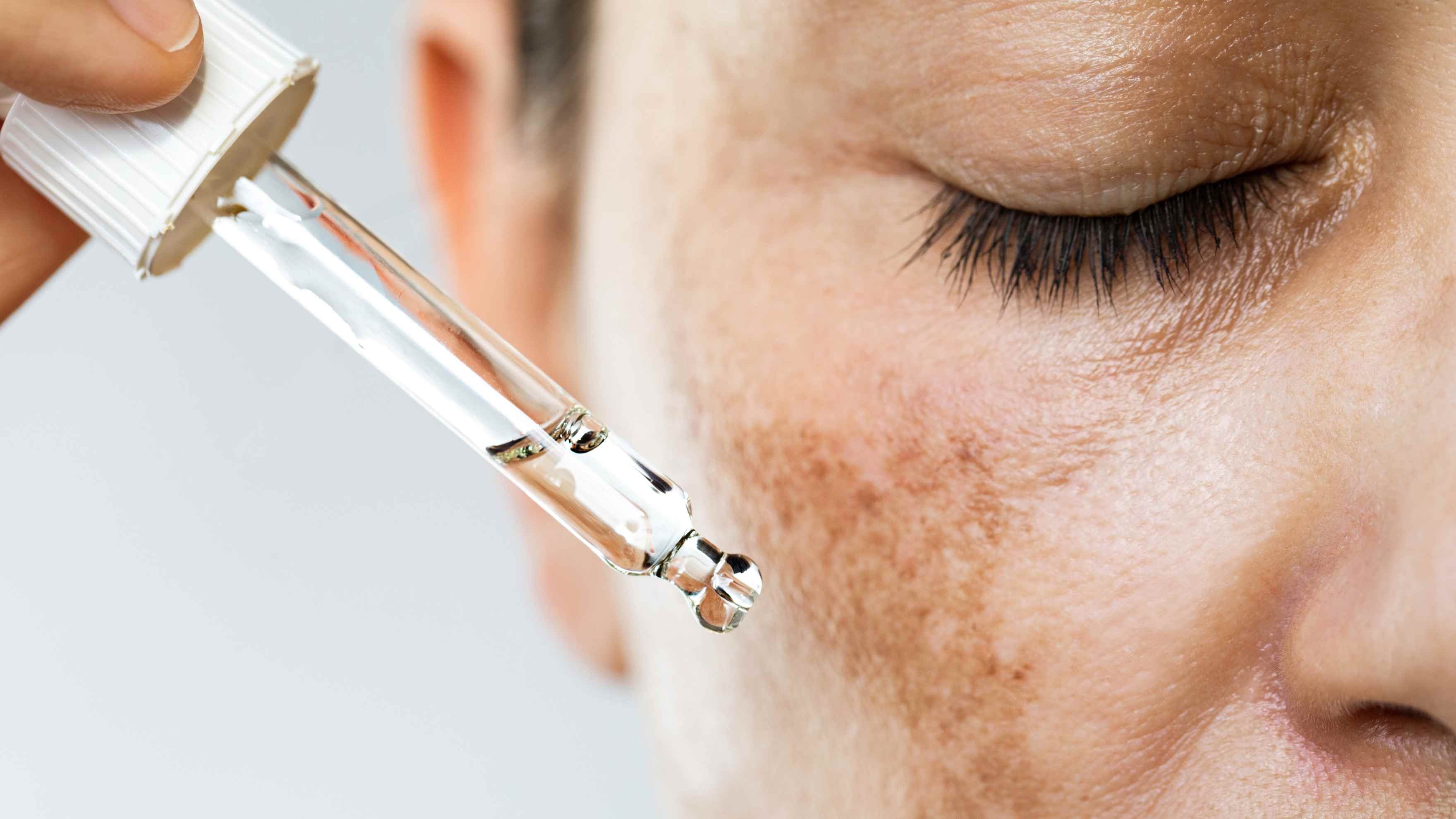 Hyperpigmentation and Dark Spots Reduction