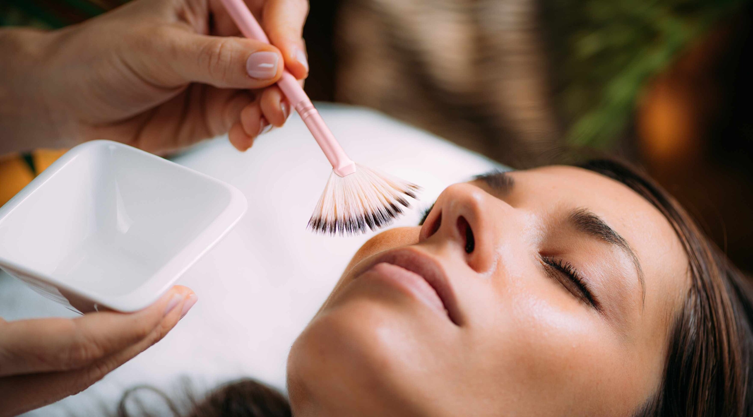 Chemical Peels