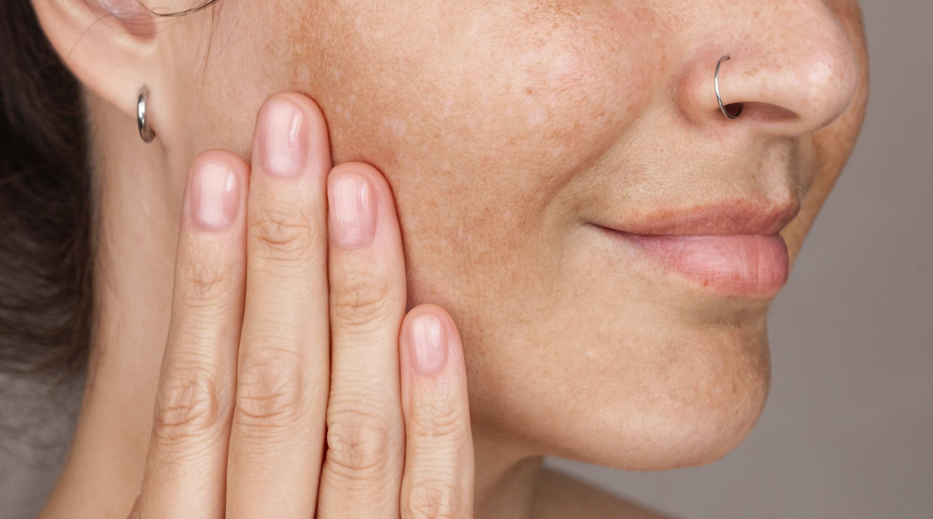 How to Reduce Melanin in Skin: Expert-Approved Tips and Treatments
