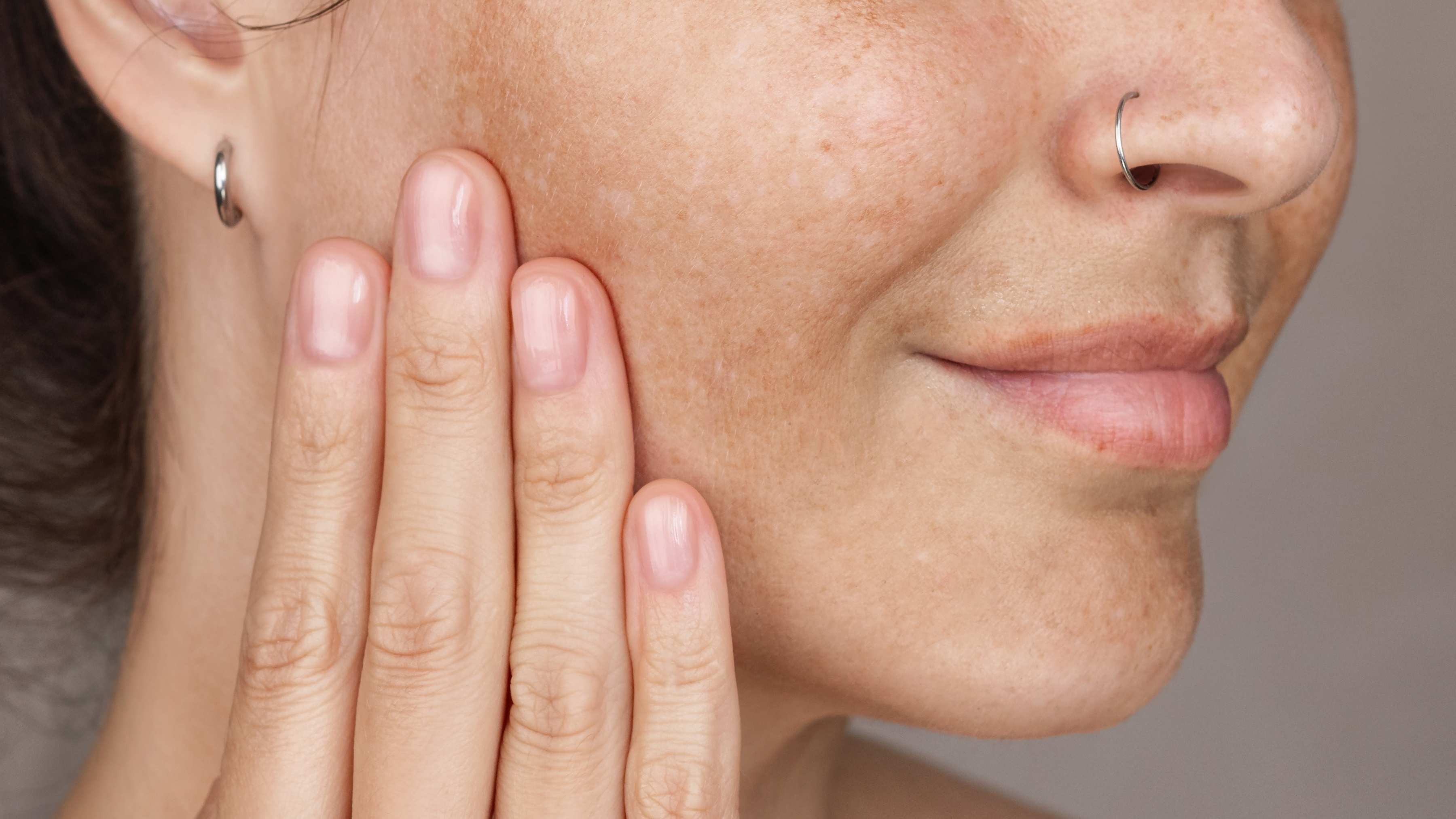 How to Reduce Melanin in Skin: Expert-Approved Tips and Treatments