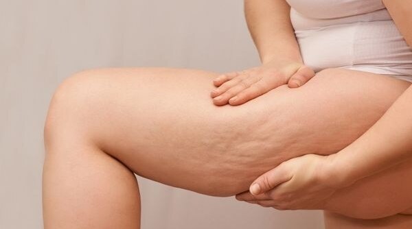 5 Surprising Ways To Get Rid Of Orange Peel Skin...