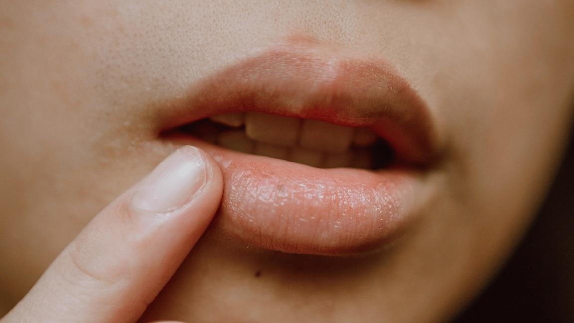 How to Get Rid of Smoker’s Lines Naturally