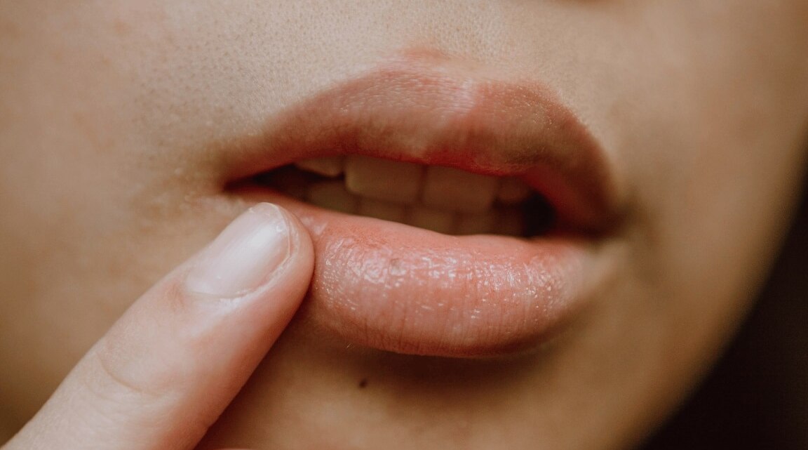How to Get Rid of Smoker’s Lines Naturally