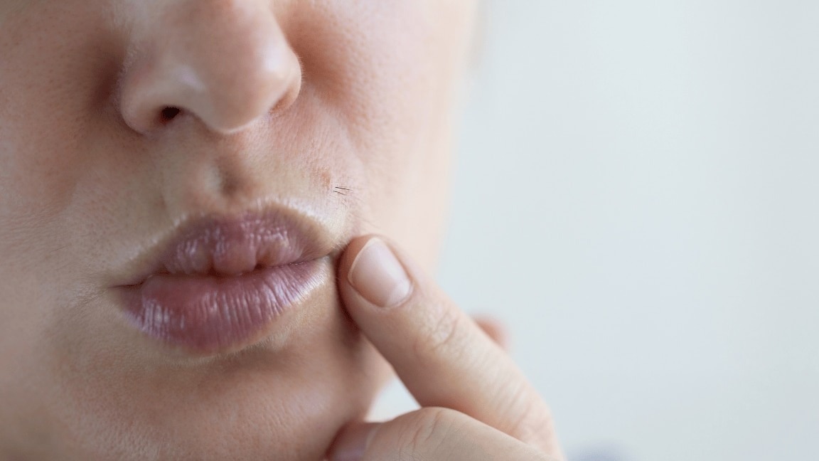 7 Easy And Natural Home Remedies To Remove Facial Hair