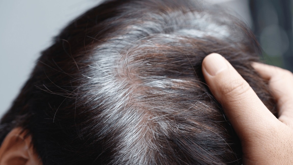 Image of How to Cover Gray Hair Without Dye? Top 5 Natural & Quick Fixes