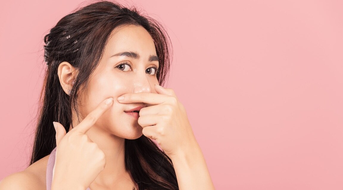 8 Effective Remedies To Reduce Heat Pimples on face naturally