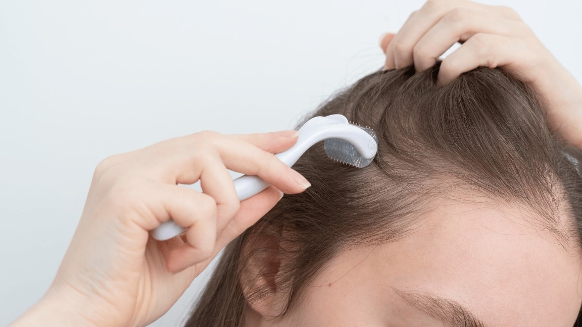 How To Use A Derma Roller For Hair Growth Correctly