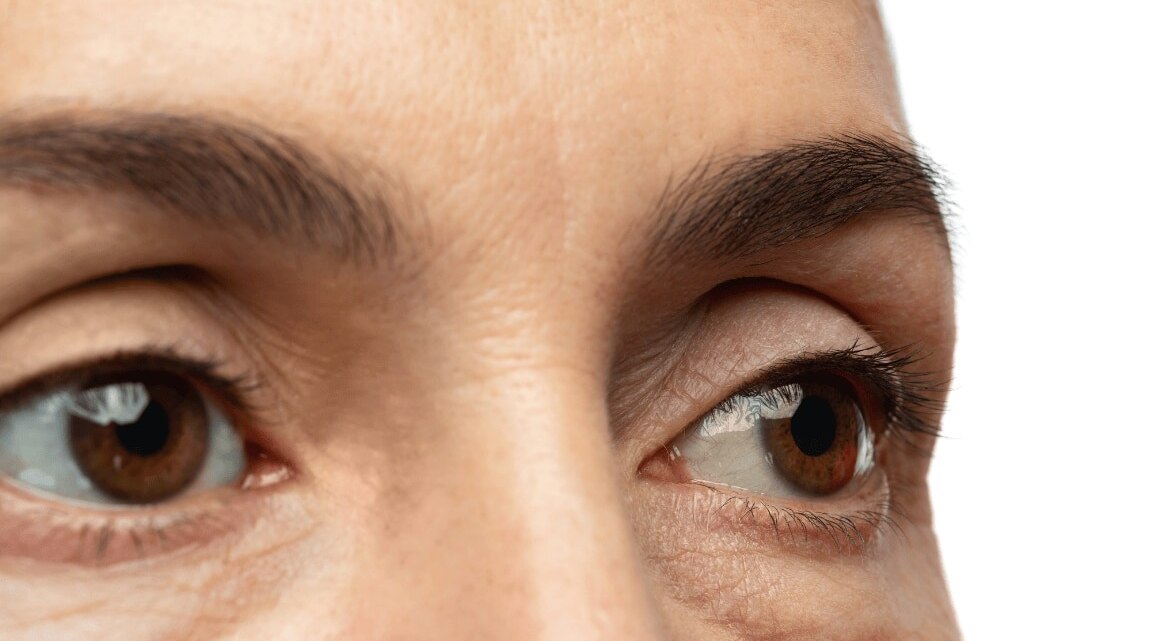 What Foods Cause Puffy Eyes? Common Triggers & How to Reduce Them