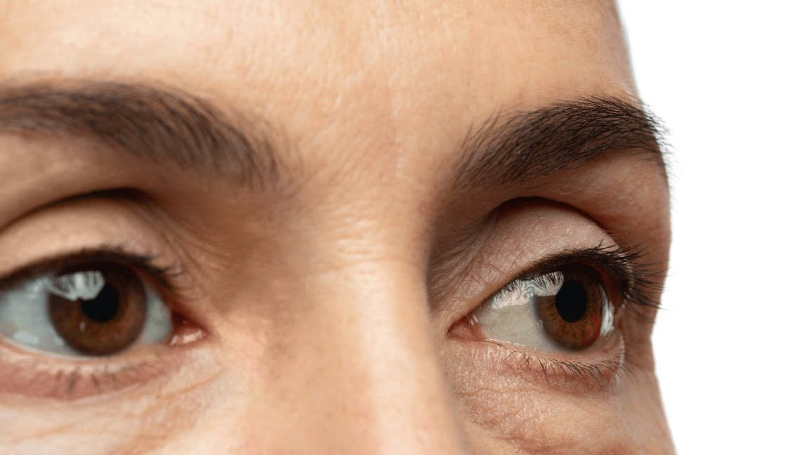 What Foods Cause Puffy Eyes? Common Triggers & How to Reduce Them