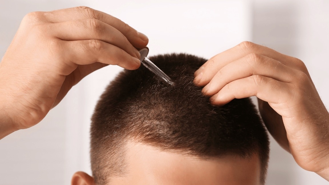 Hairline Growth Tips: How to Stop a Receding Hairline and Regrow Hair Naturally