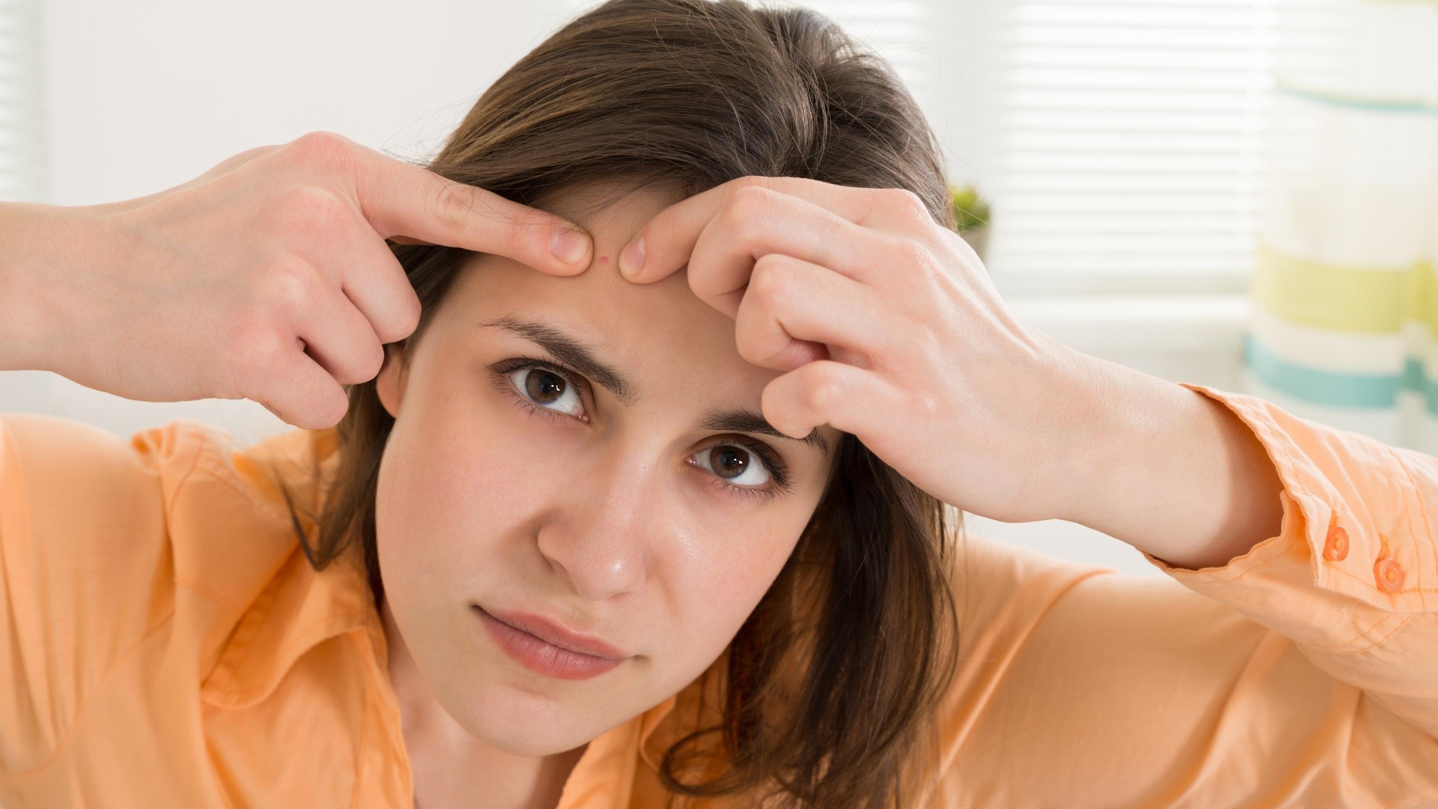 How To Prevent a Pimple from Growing: Expert Tips & Remedies