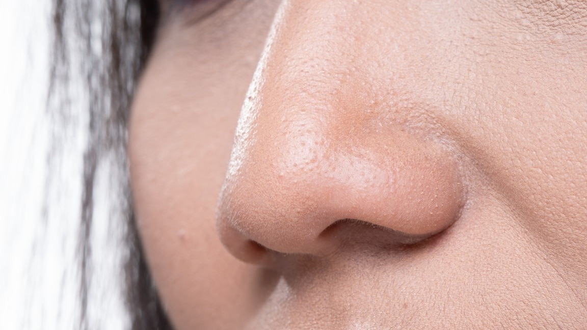 How to get Rid of Redness around the Nose