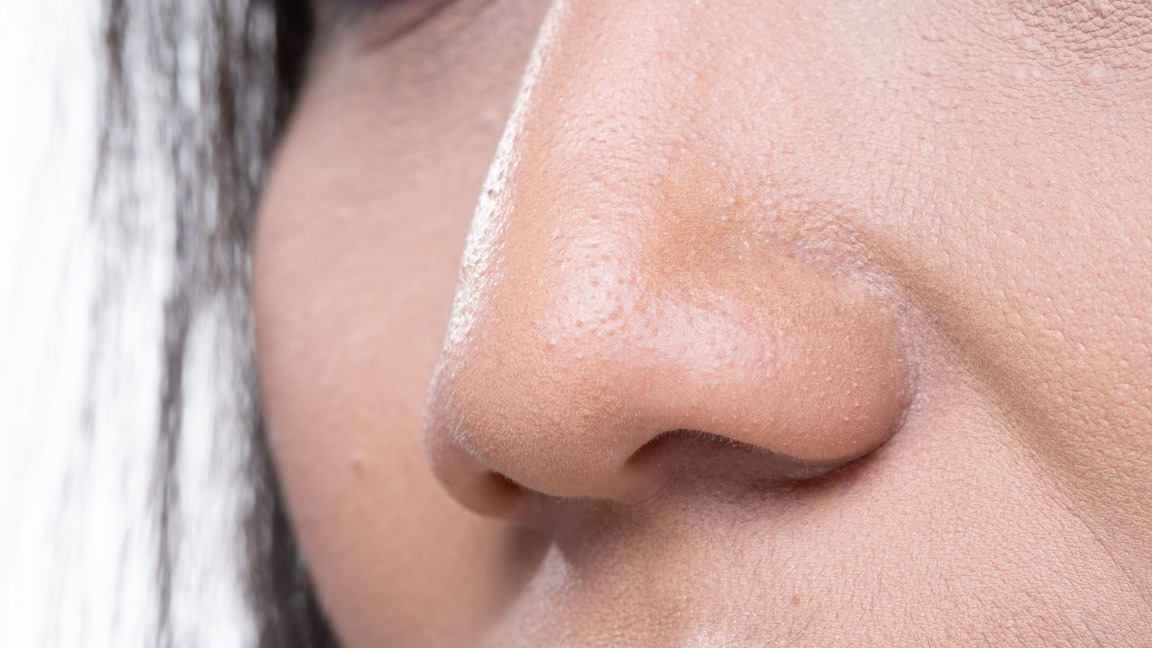 How to get Rid of Redness around the Nose