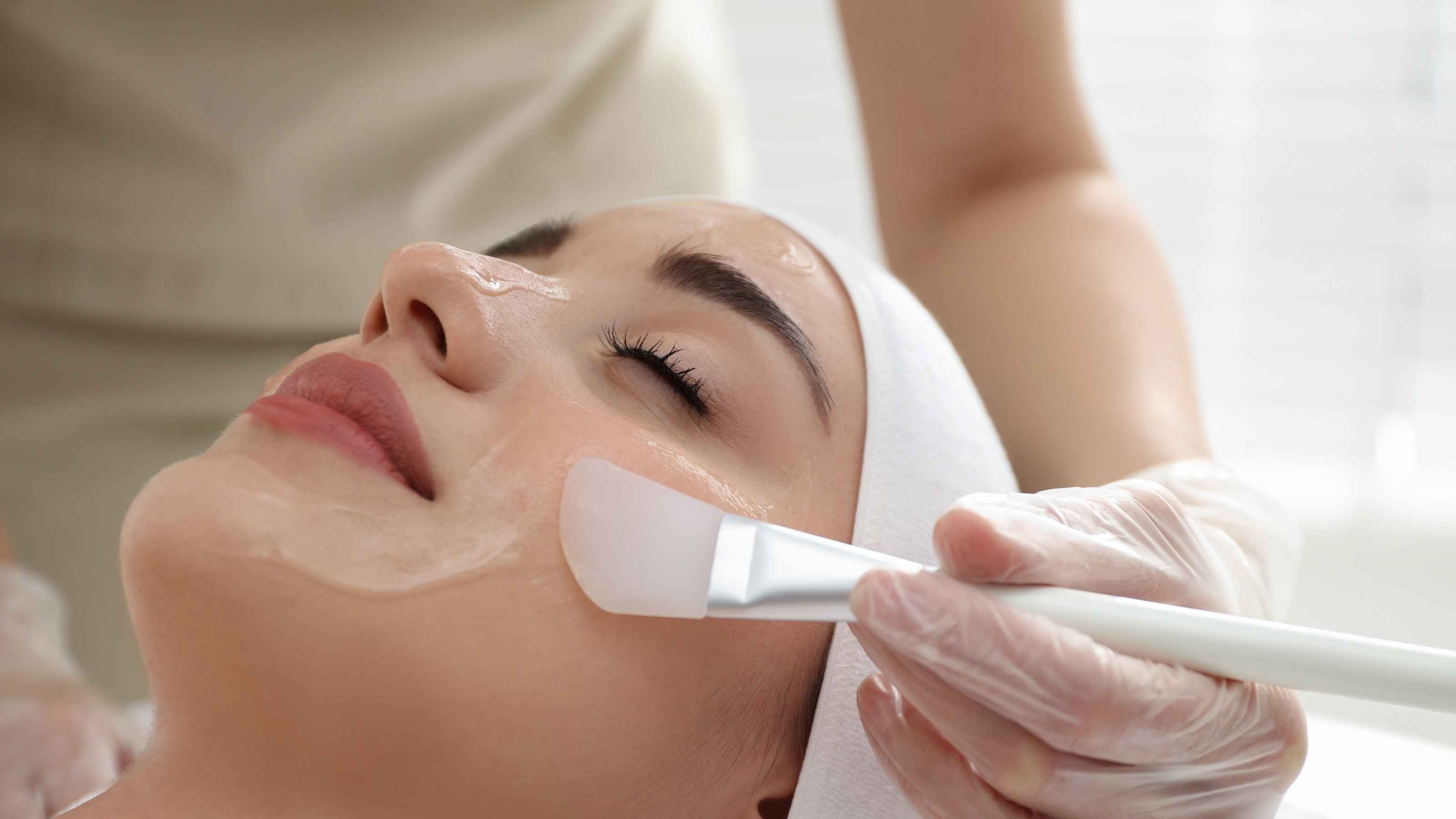 Chemical peels