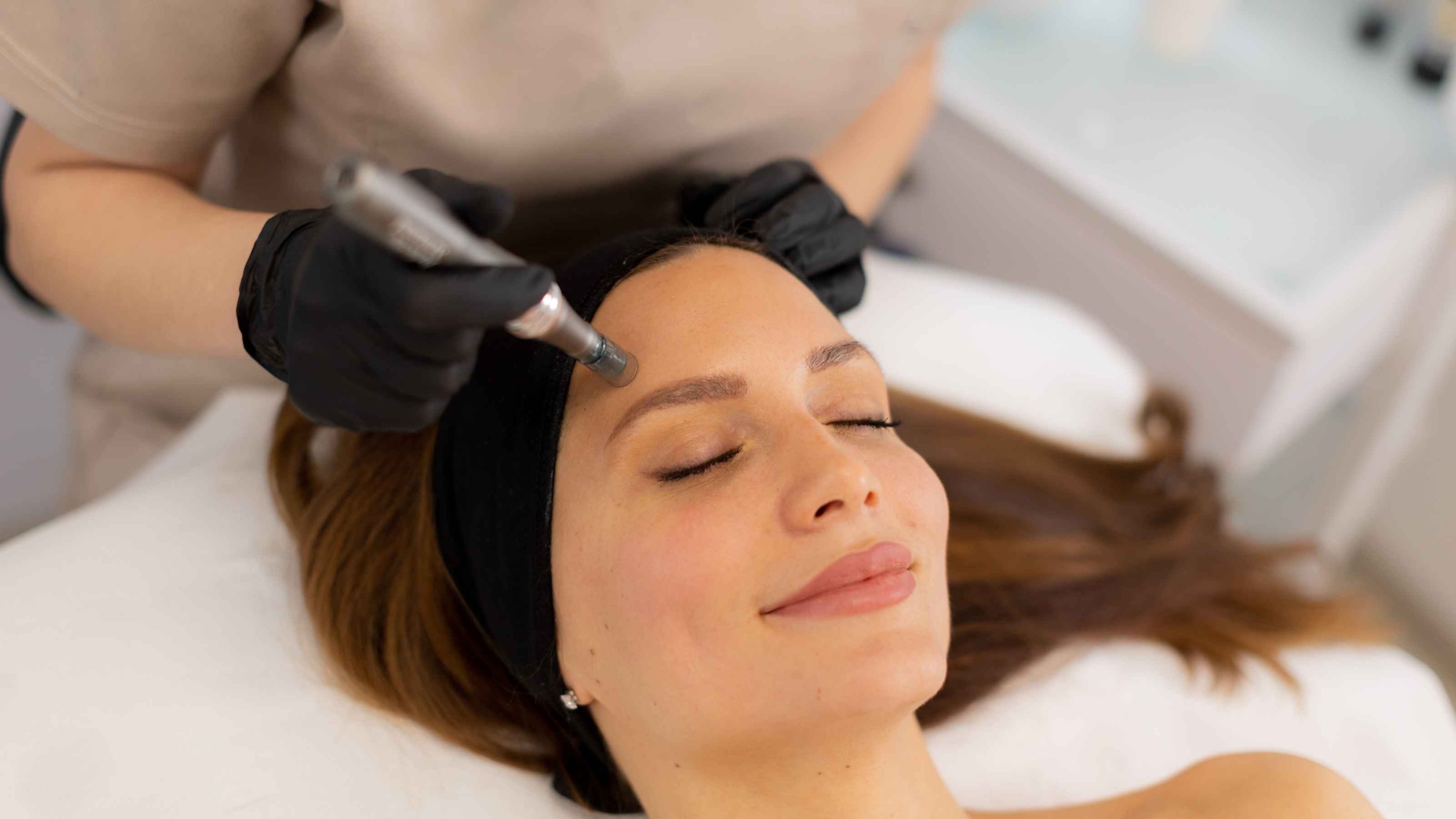 Microneedling