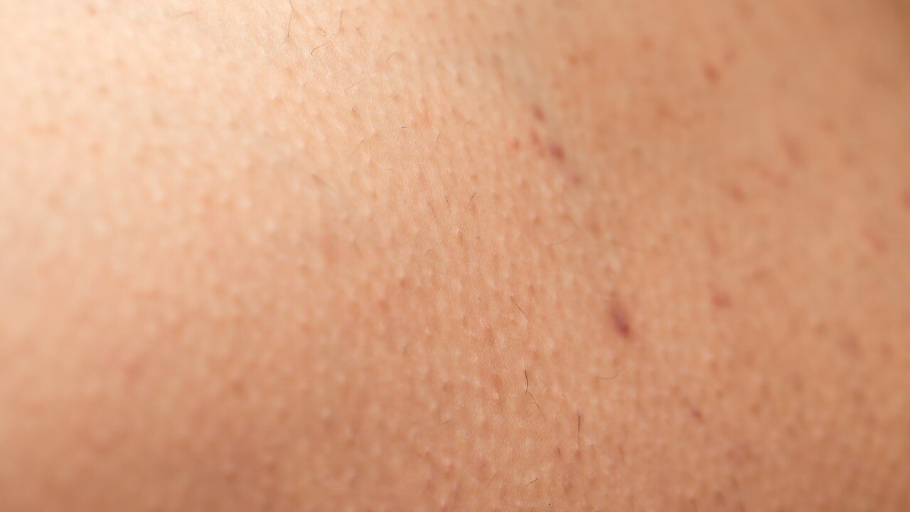Sweat and Friction