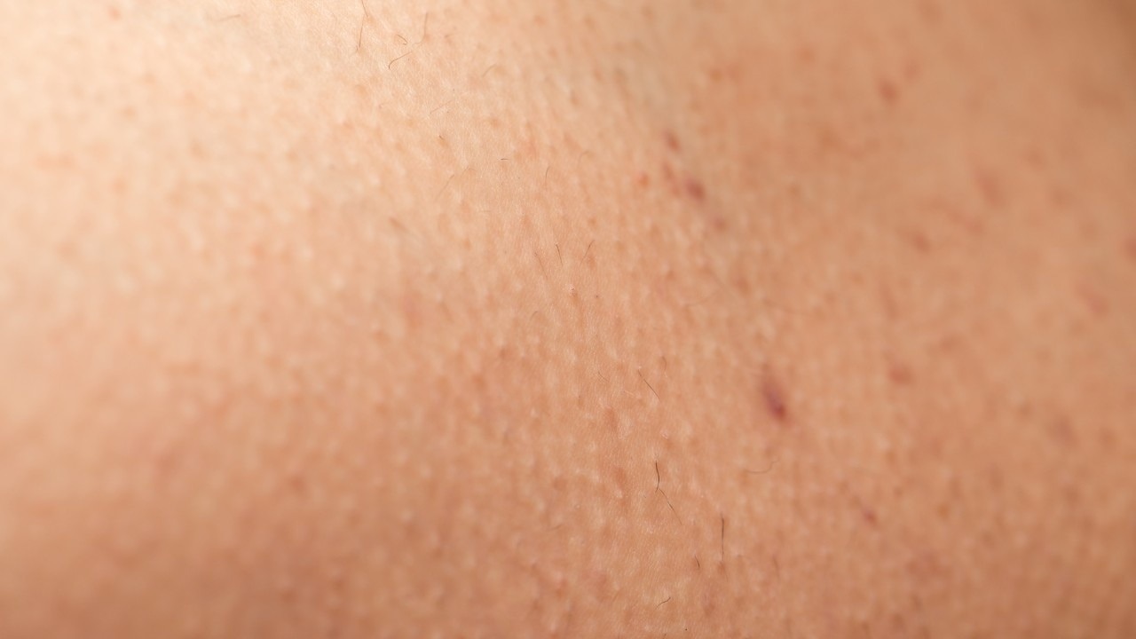 Sweat and Friction