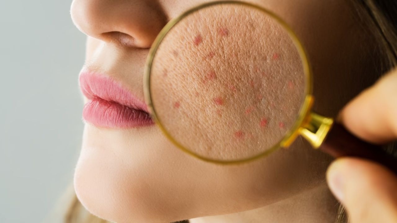 Your skin barrier is weakened