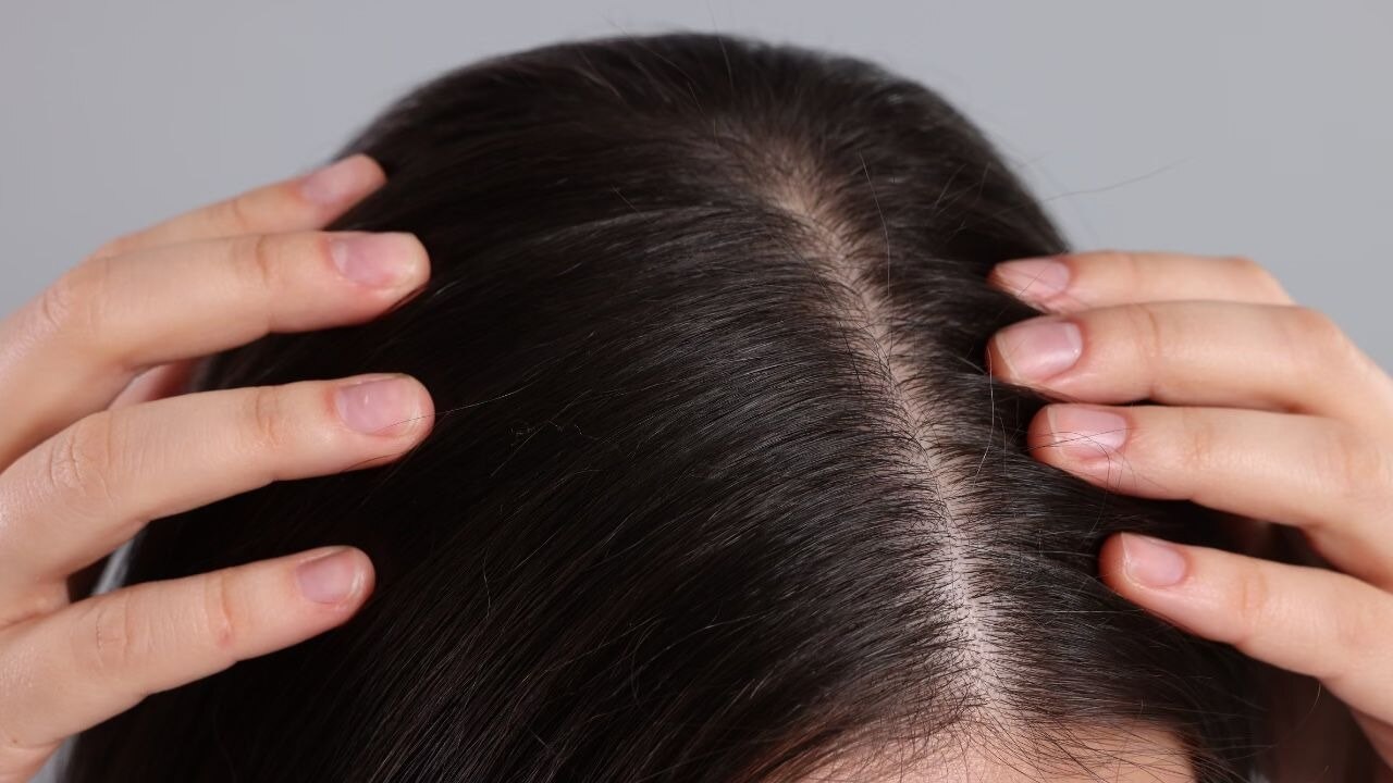 Scalp Health