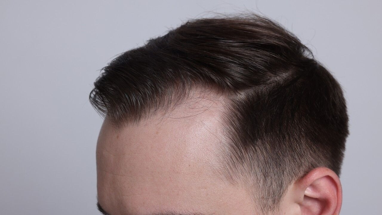Tretinoin The Secret Hair Growth Ingredient