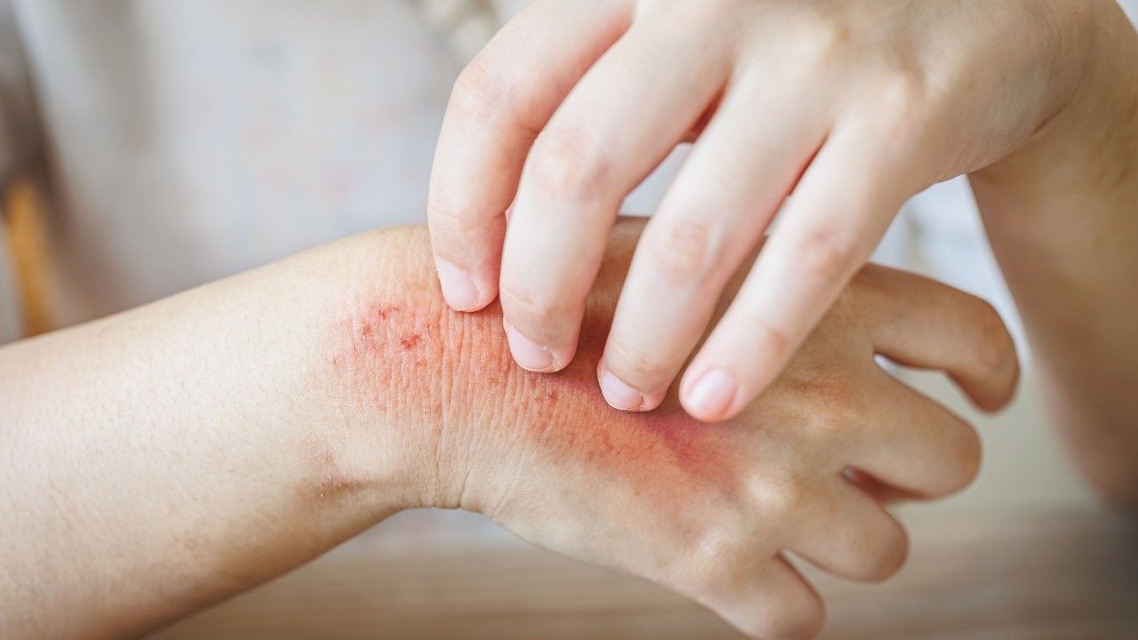 Higher risk of fungal infections: