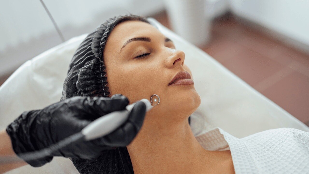 How-to-remove-facial-warts