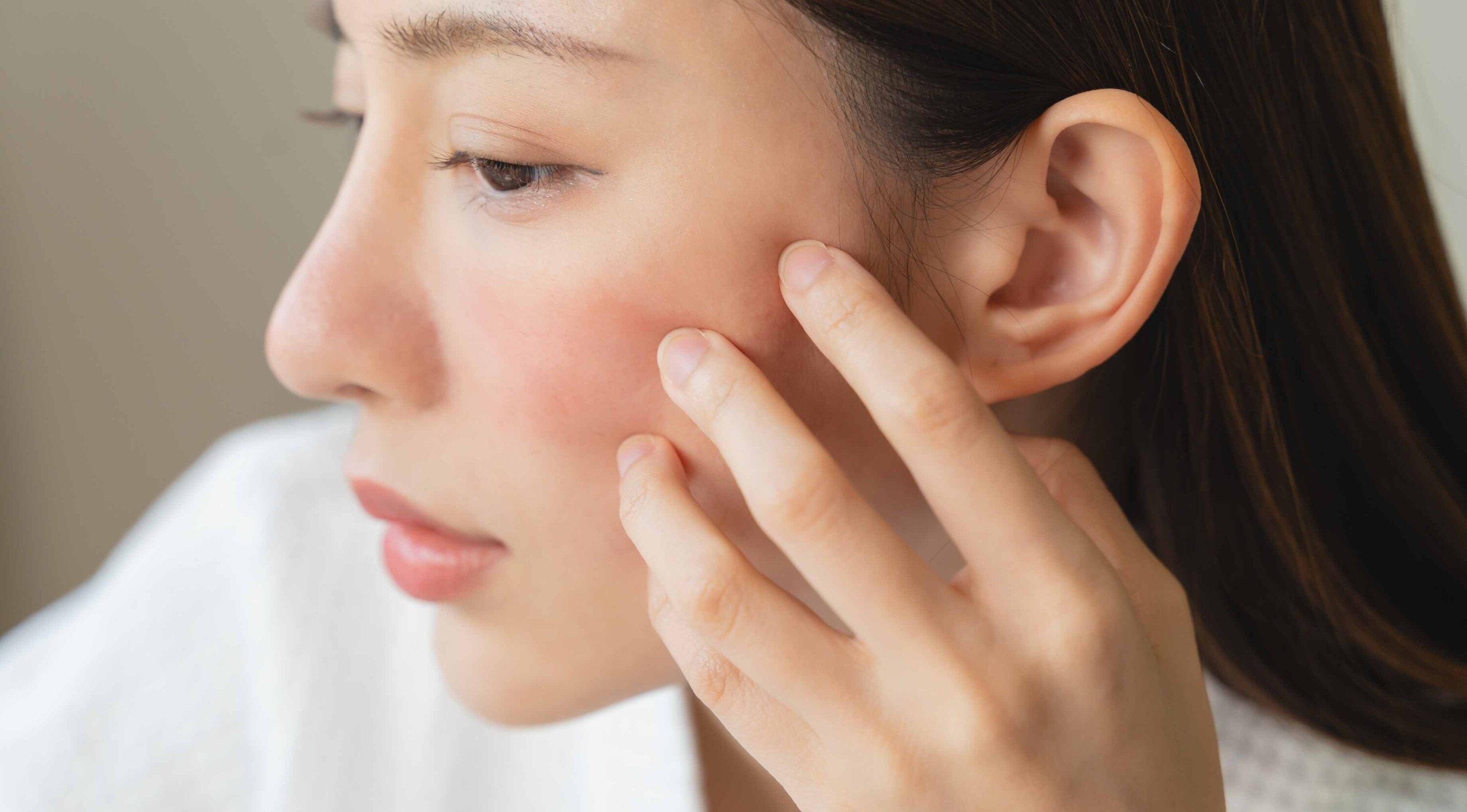 How to Identify a Chemical Burn from Skincare