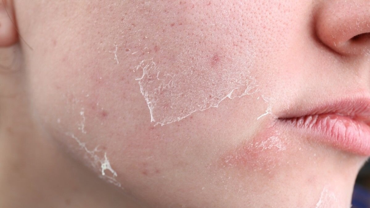 Dry &amp; Sensitive Skin