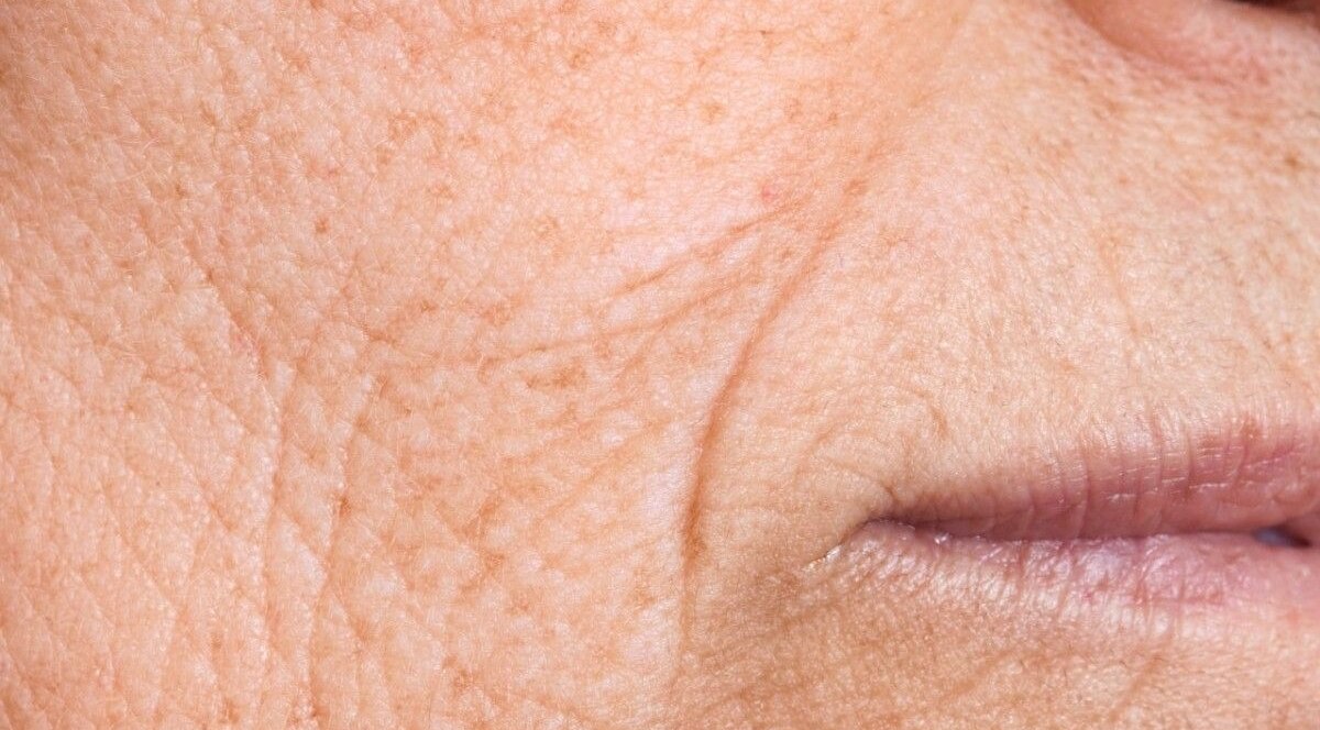 Reduces Fine Lines and Wrinkles