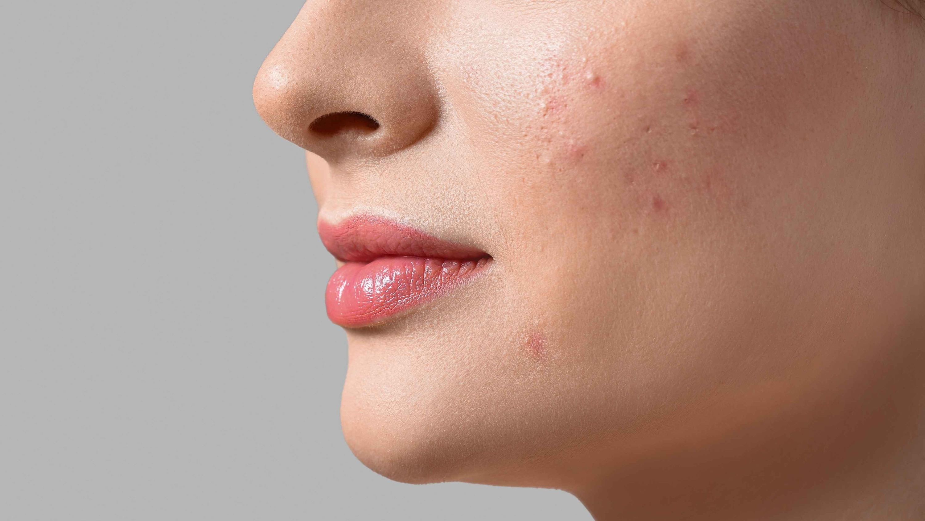 Signs You May Have an Iodine Deficiency Affecting Your Skin