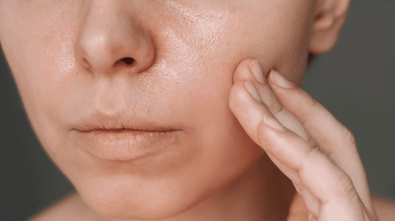 Dry, Sensitive Skin