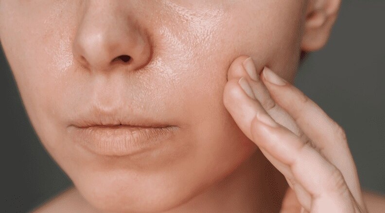 Dry, Sensitive Skin