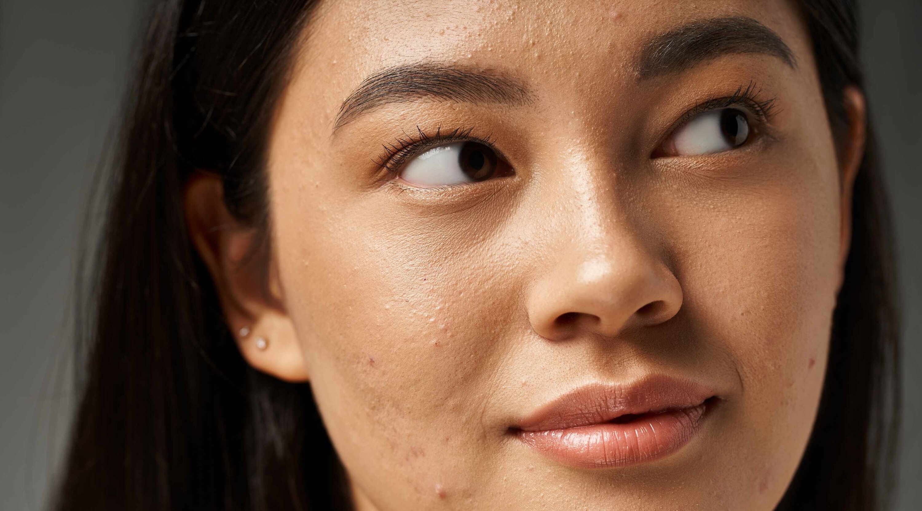 Primary Causes of Pimples on the Face