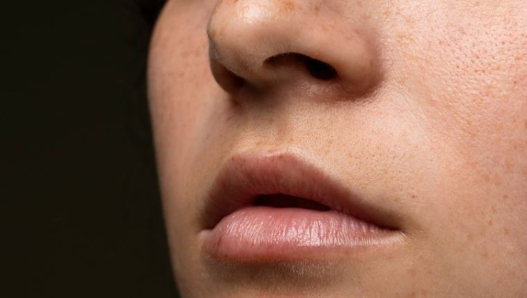 Reduces Pigmentation and Evens out Skin Tone
