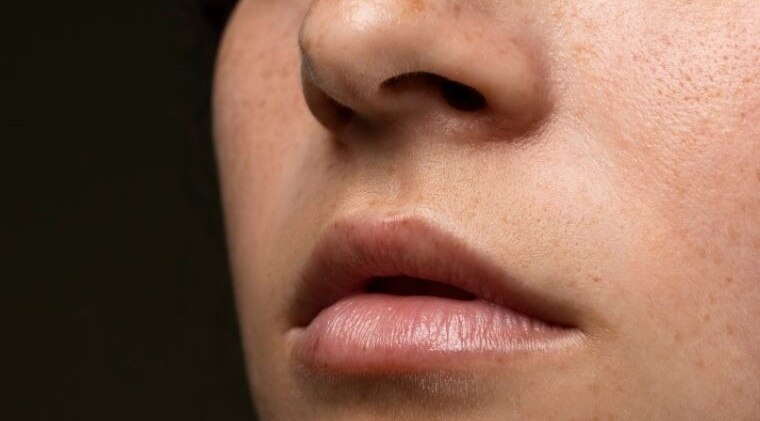 Reduces Pigmentation and Evens out Skin Tone