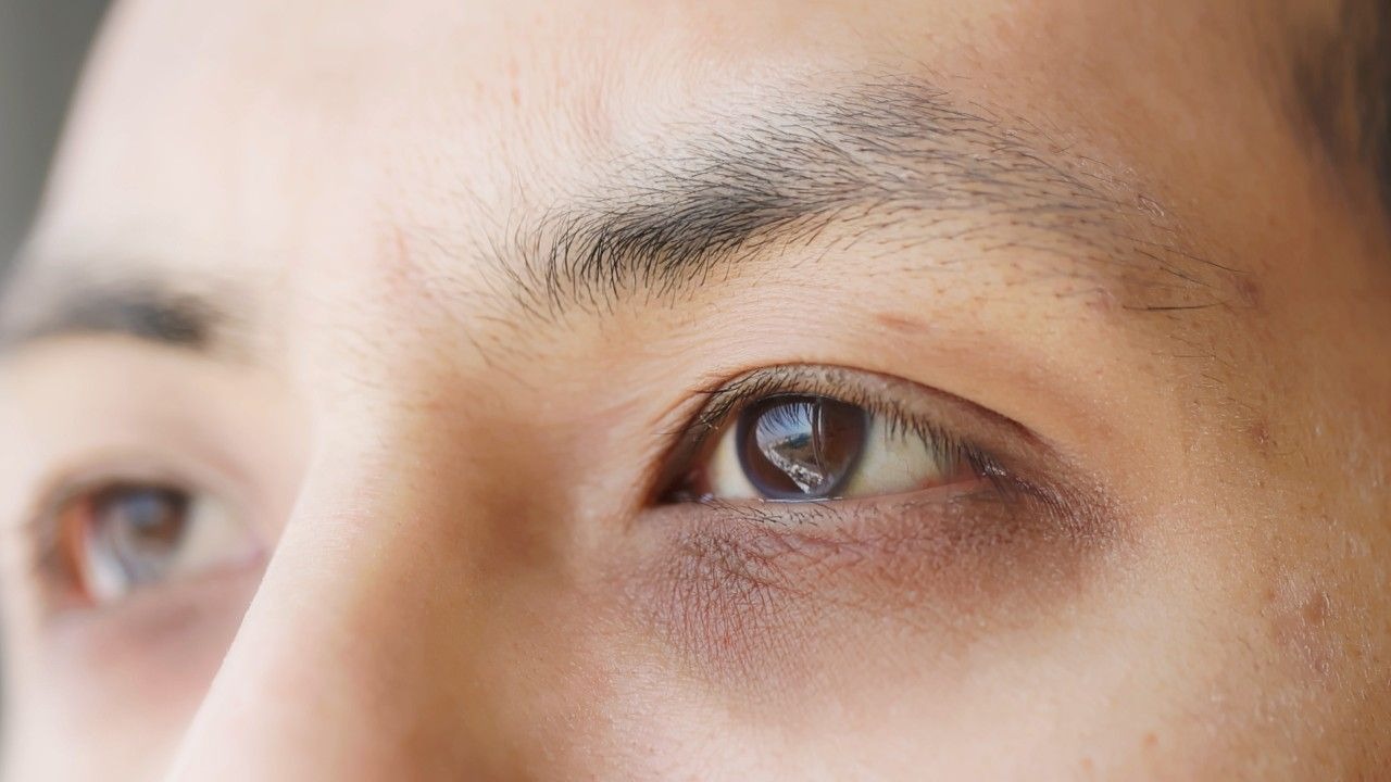 Deep, Dark Circles