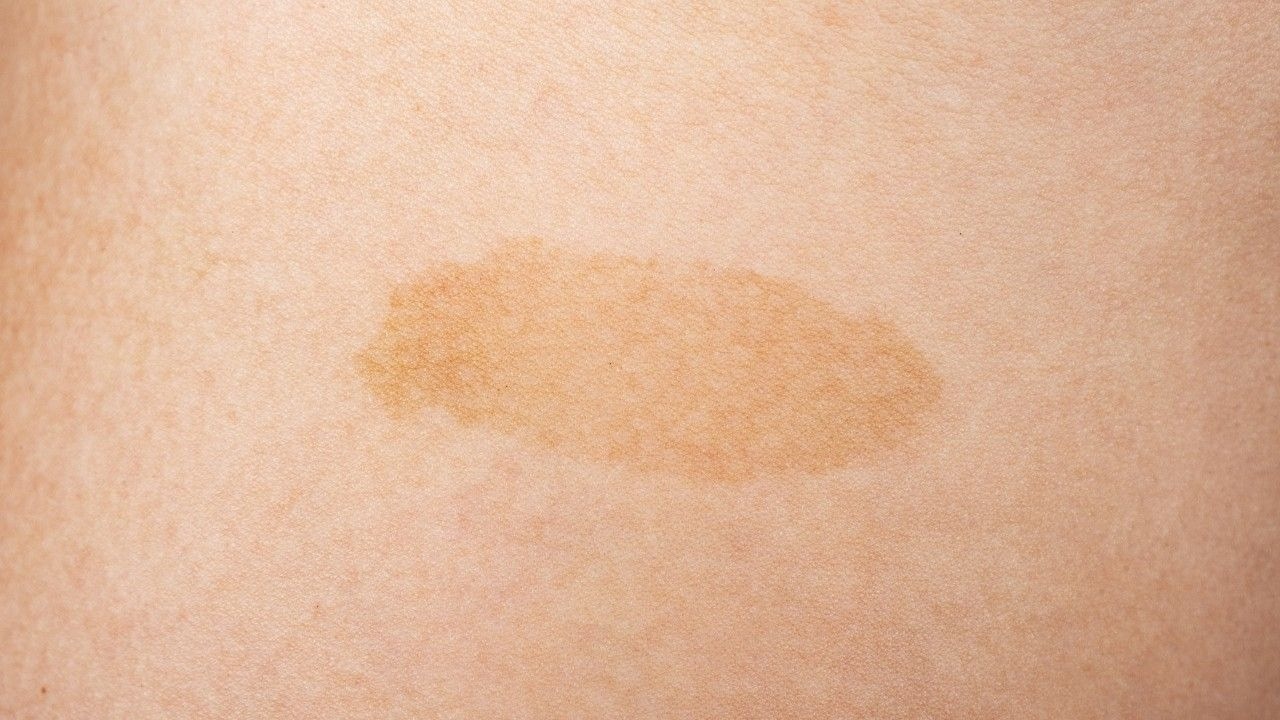 You Have Yellow or Pale Skin