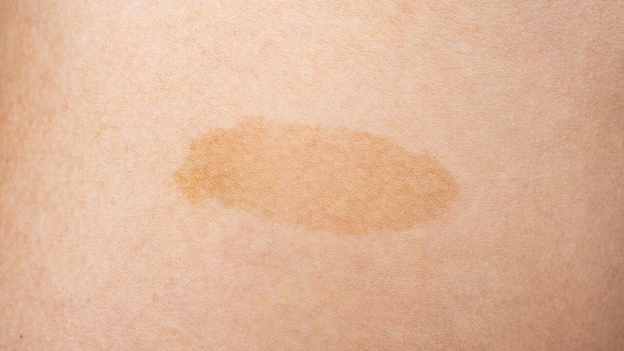 You Have Yellow or Pale Skin