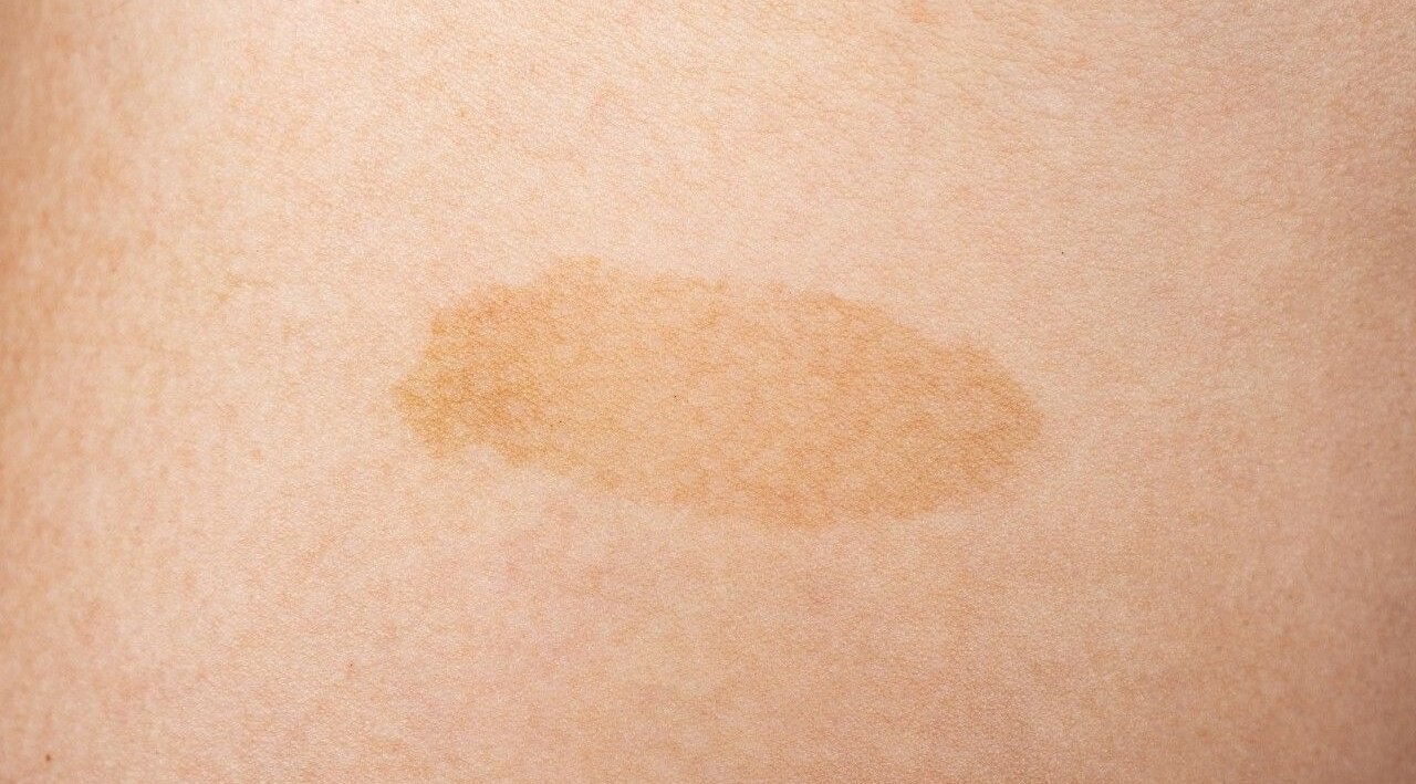 You Have Yellow or Pale Skin