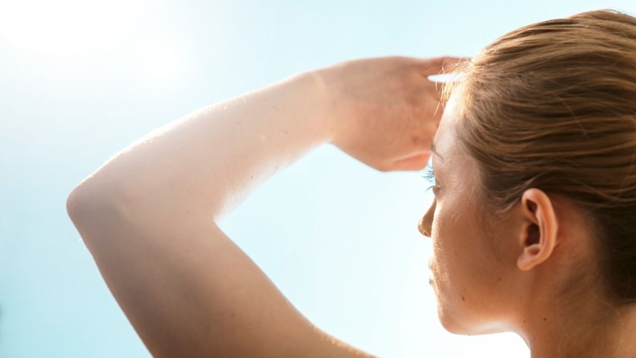 Hyperpigmentation due to sun exposure