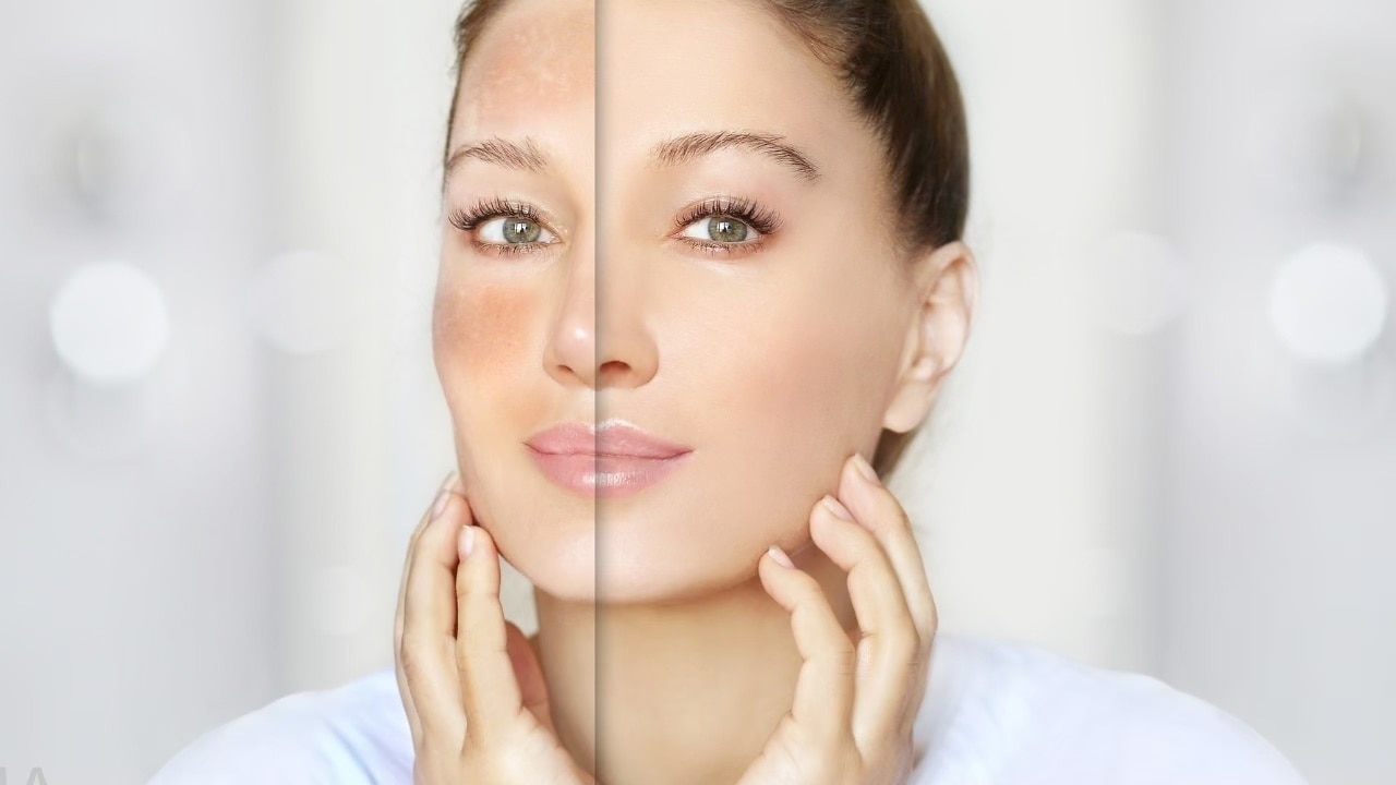 Evens  Skin Tone &amp; Lightens Pigmentation 