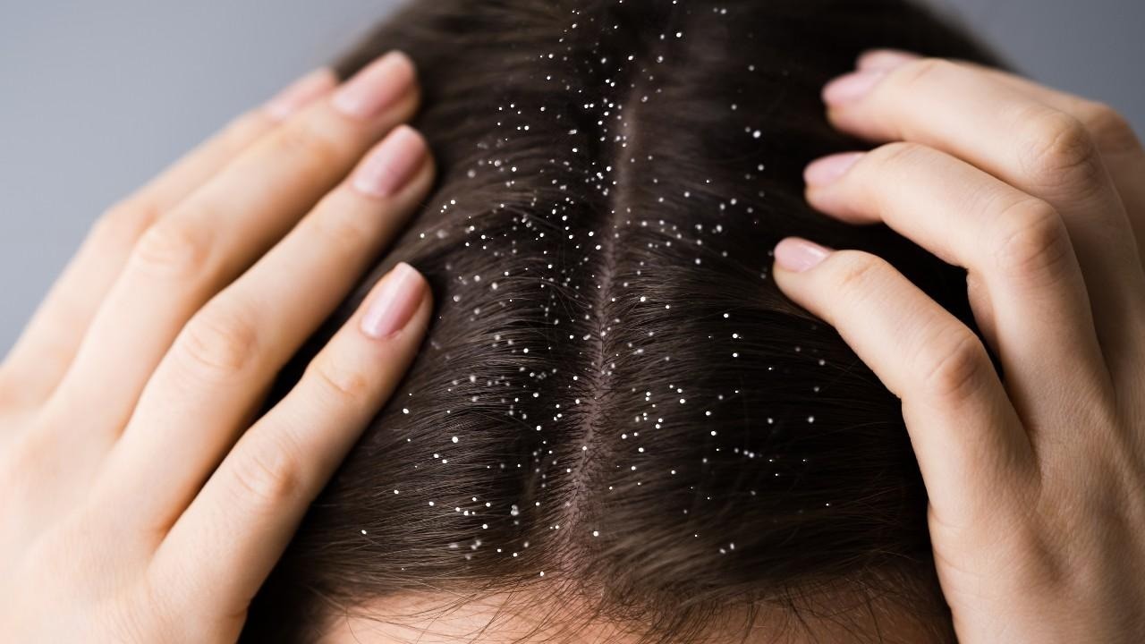 Soothes Itchy and Irritated Scalp