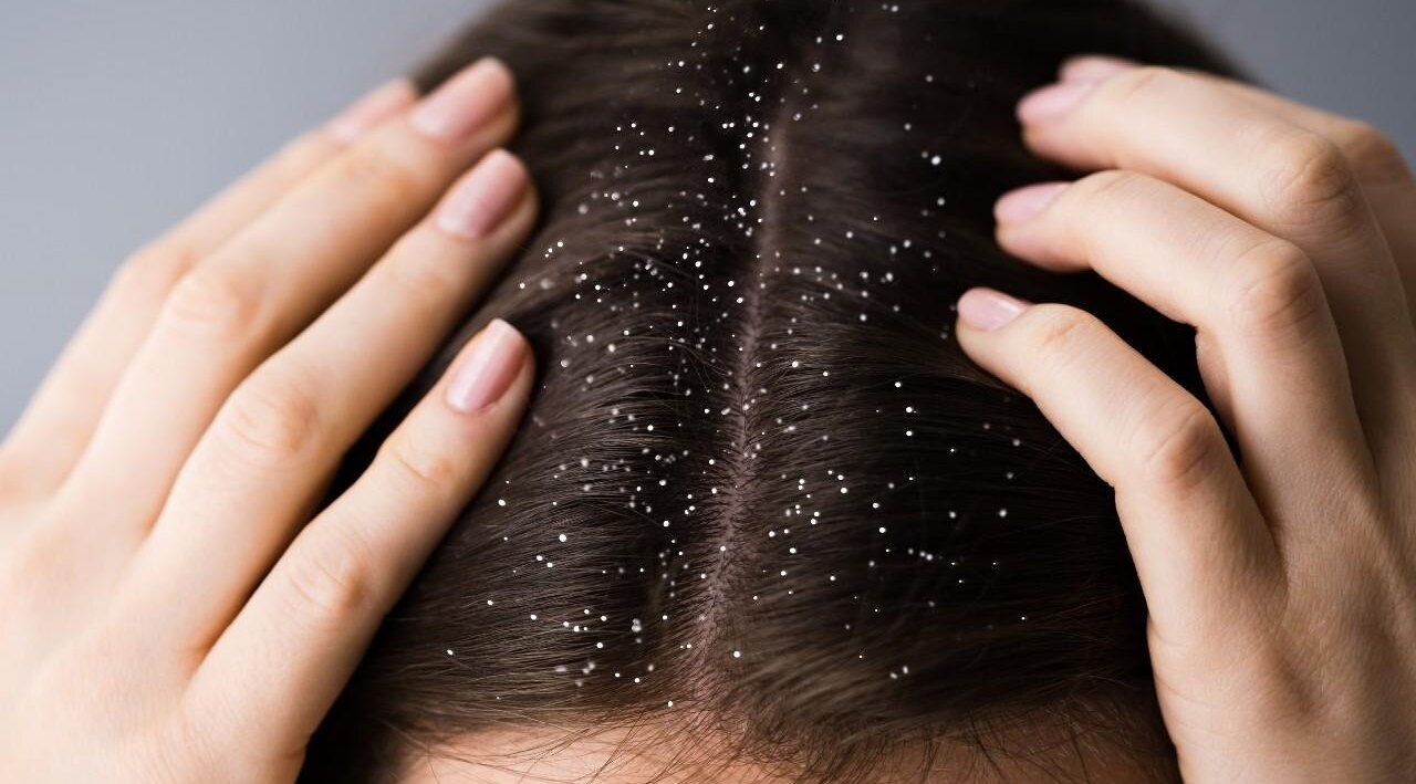 Soothes Itchy and Irritated Scalp