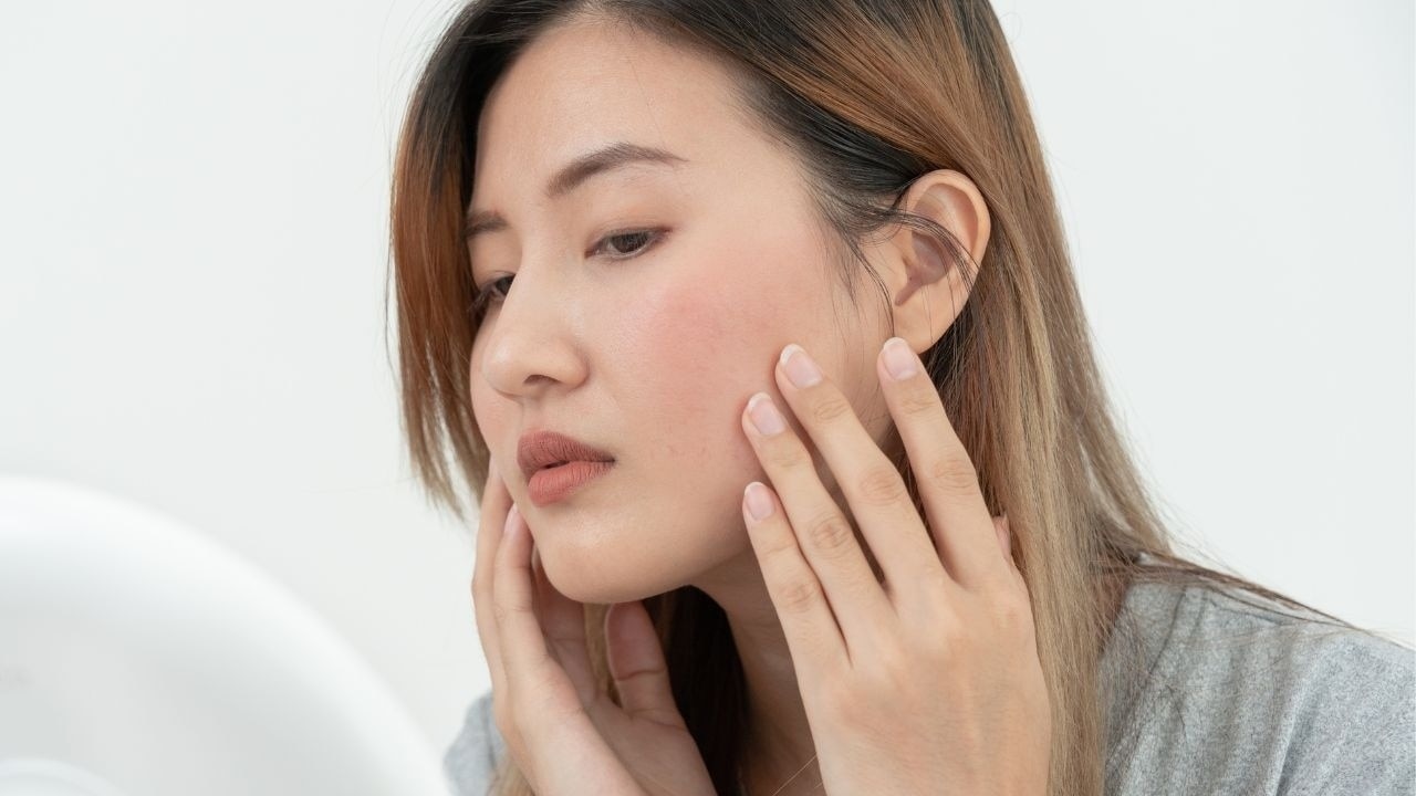 Fights Skin Inflammation