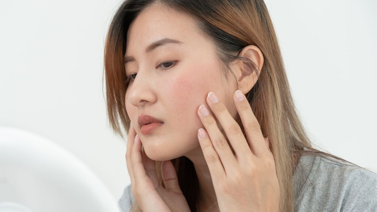 Fights Skin Inflammation