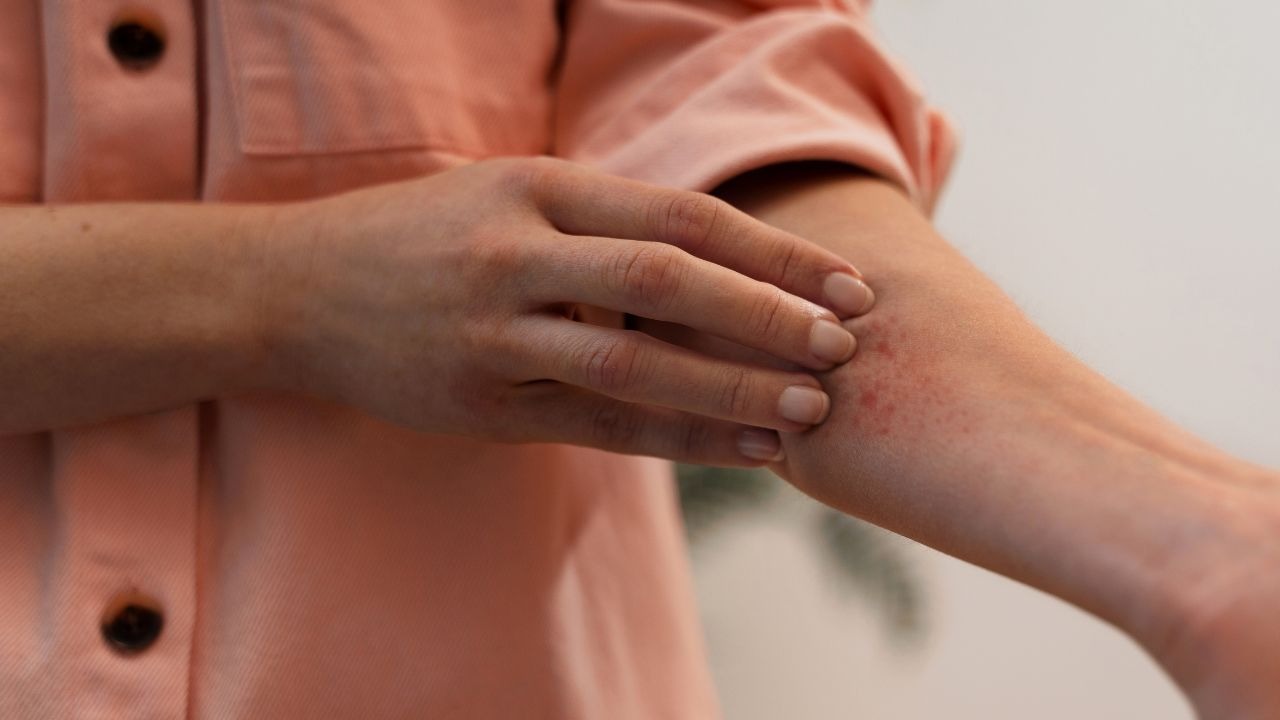 Immediate Steps to Take After Bleaching Burns